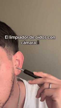 Limpiador de Oídos con Cámara HD