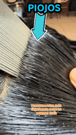 Cepillo Aspirador Saca Piojos y Liendres
